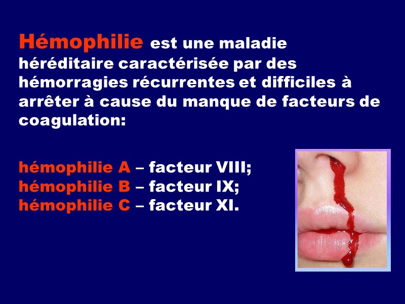 Hémophilie est une maladie héréditaire caractérisée par des hémorragies récurrentes et difficiles à arrêter